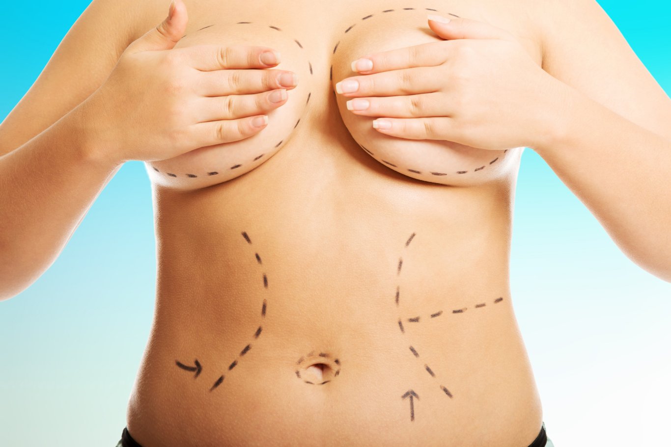 Dr. Trussler Body Surgery