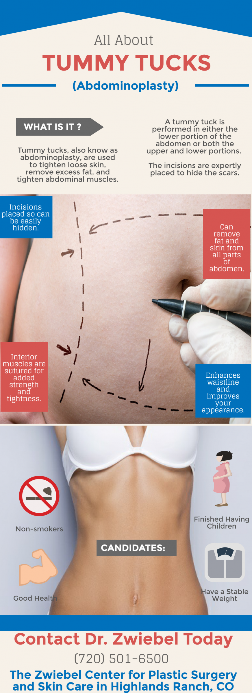 Tummy Tucks | Abdominoplasty | Plastic Surgery | Highlands Ranch, CO