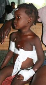 zwiebel_Haiti_orphan